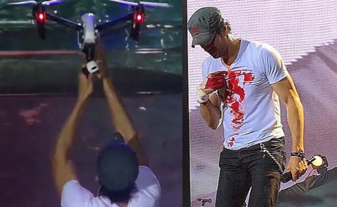 Enrique Iglesias sliced his fingers during a concert
